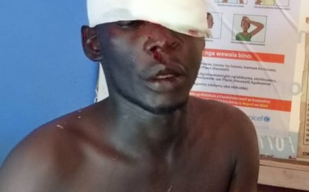 Top TV Journalist Injured in Kawempe By-election Chaos.